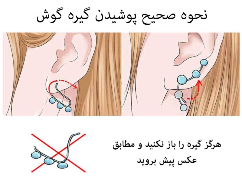 نحوه صحیح انداختن گیره گوش